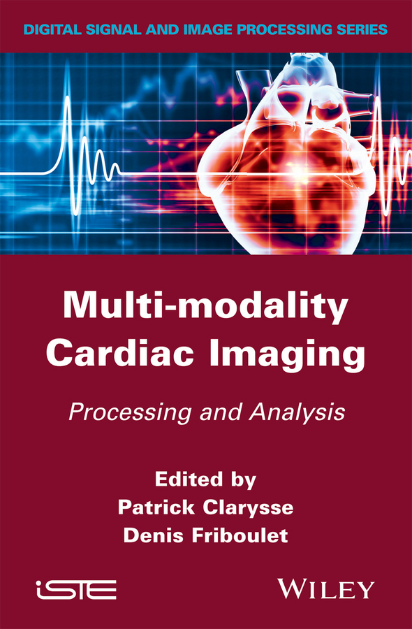 Multi-modality Cardiac Imaging. Processing and Analysis