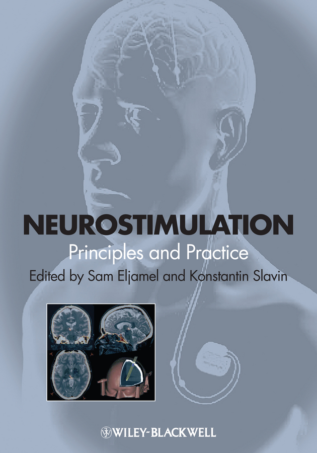 Neurostimulation. Principles and Practice