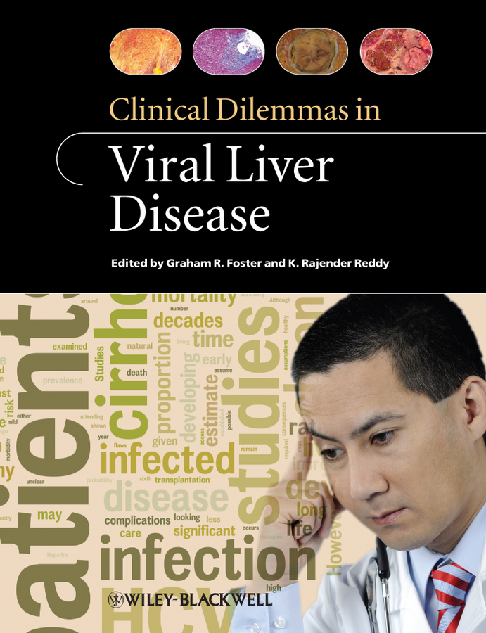 Foster Graham Clinical Dilemmas in Viral Liver Disease