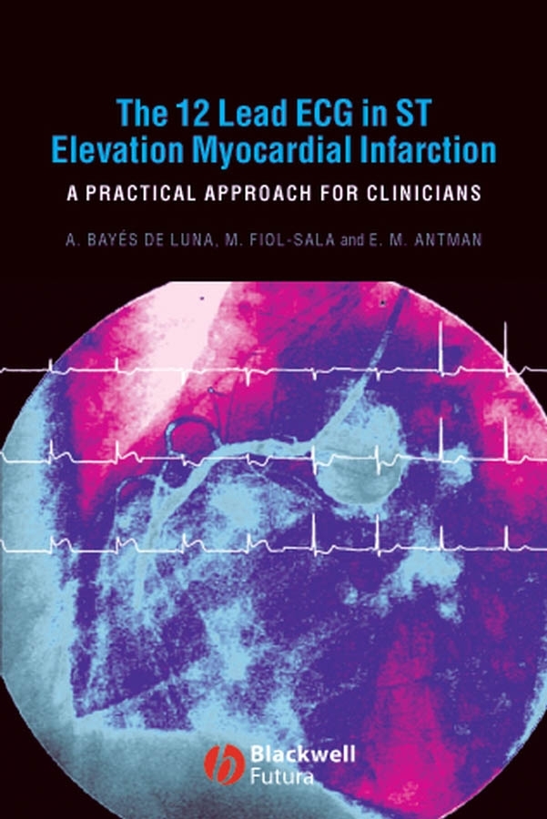 Antoni Bayés de Luna, The 12 Lead ECG in ST Elevation Myocardial ...