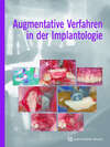 Augmentative Verfahren in der Implantologie