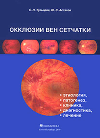 Ю. С. Астахов — Окклюзии вен сетчатки (этиология, патогенез, клиника, диагностика, лечение)