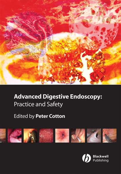 Peter Cotton B. - Advanced Digestive Endoscopy. Practice and Safety