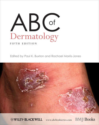 Morris-Jones Rachael - ABC of Dermatology