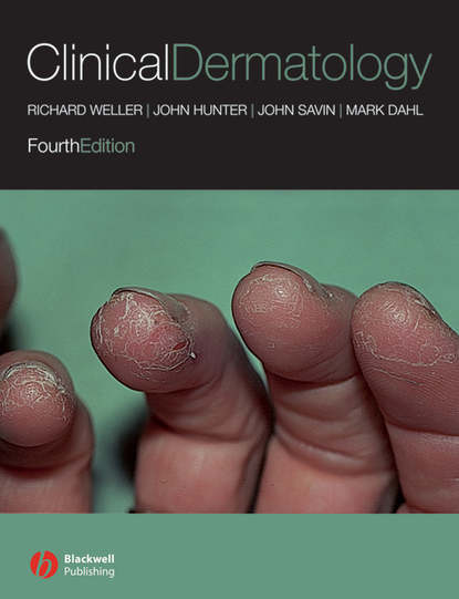 

Clinical Dermatology