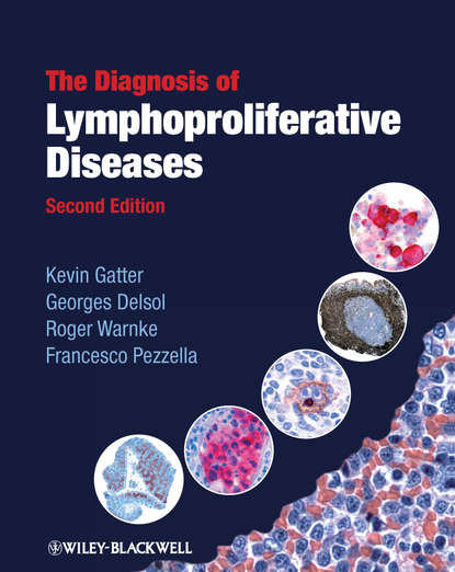 The Diagnosis of Lymphoproliferative Diseases - Kevin Gatter