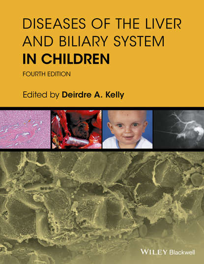 Diseases of the Liver and Biliary System in Children - Группа авторов