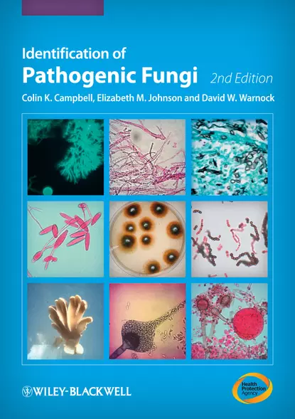 Обложка книги Identification of Pathogenic Fungi, Colin K. Campbell