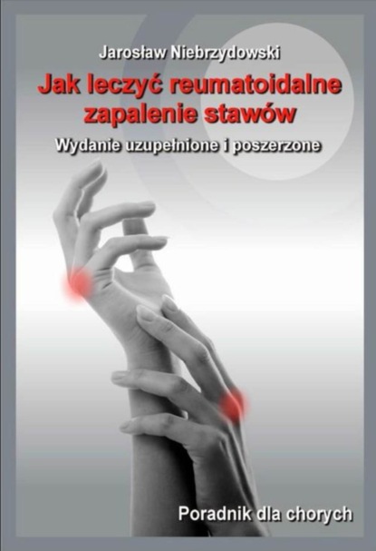 

Jak leczyć reumatoidalne zapalenie stawów II