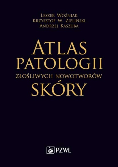 Leszek Woźniak - Atlas patologii złośliwych nowotworów skóry