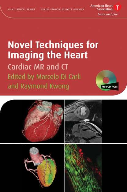 Marcelo Carli F.Di - Novel Techniques for Imaging the Heart