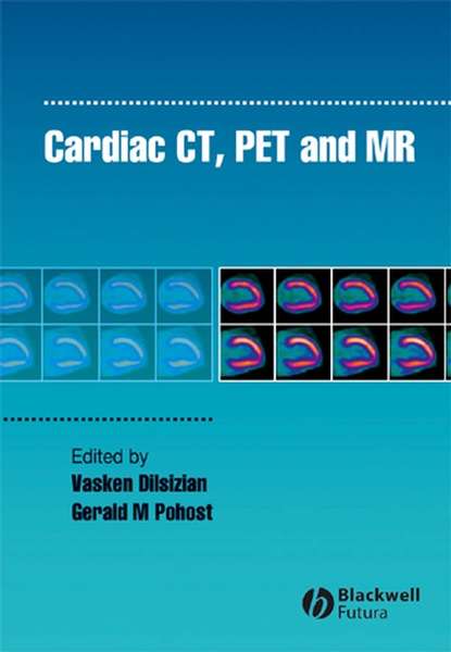 Vasken  Dilsizian - Cardiac CT, PET and MR