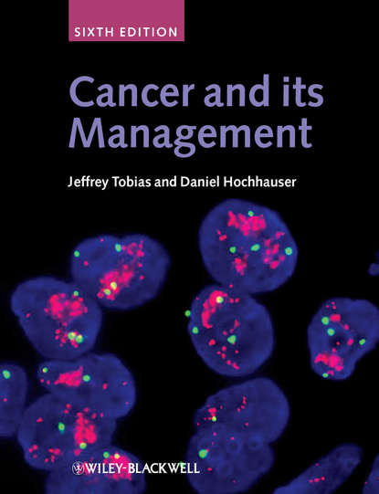 Daniel  Hochhauser - Cancer and its Management