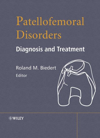 Patellofemoral Disorders - Группа авторов