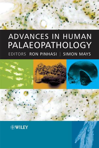 Simon  Mays - Advances in Human Palaeopathology