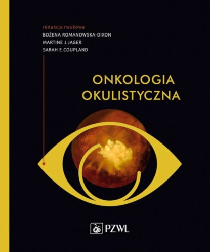 Группа авторов - Onkologia okulistyczna