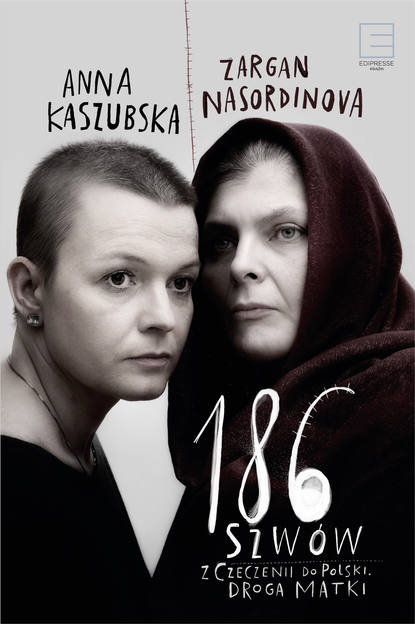 

186 szwów. Z Czeczenii do Polski. Droga matki