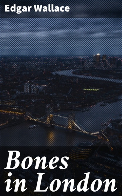 

Bones in London