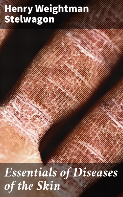 

Essentials of Diseases of the Skin