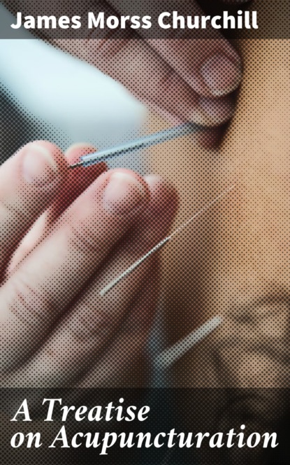 

A Treatise on Acupuncturation