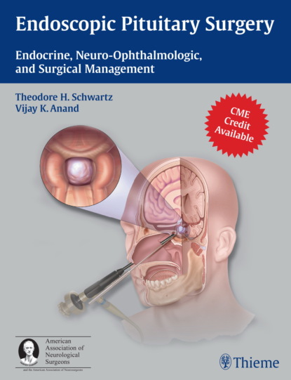 Группа авторов - Endoscopic Pituitary Surgery