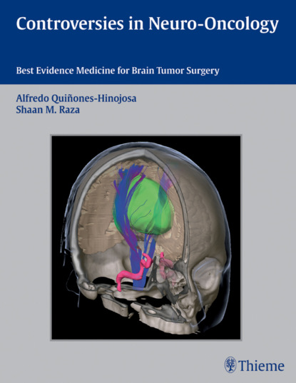 Группа авторов - Controversies in Neuro-Oncology