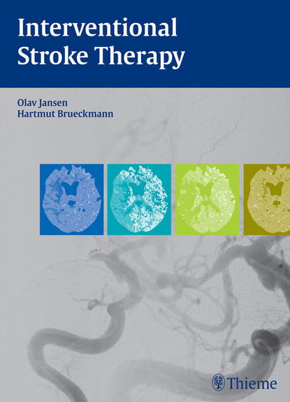 Olav Jansen - Interventional Stroke Therapy