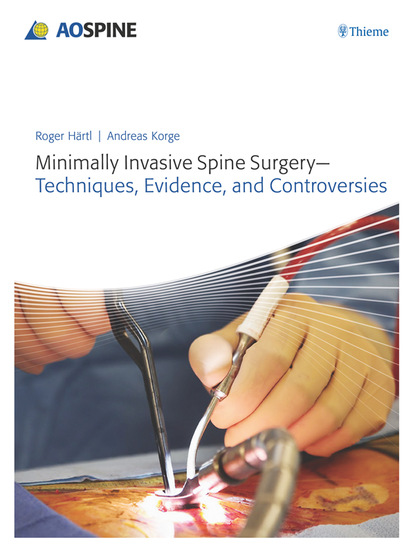 Roger Haertl - Minimally Invasive Spine Surgery