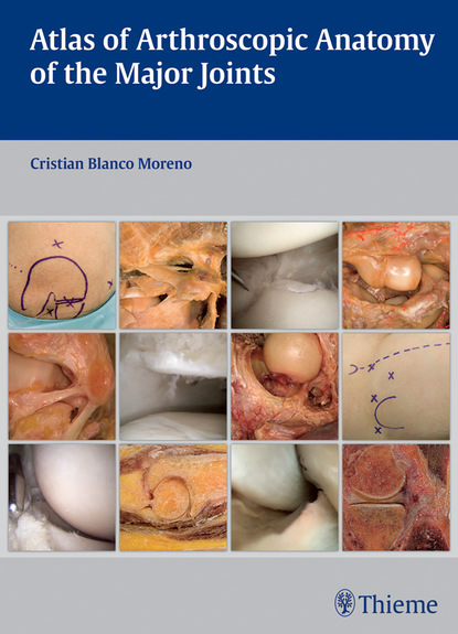 

Atlas of Arthroscopic Anatomy of the Major Joints