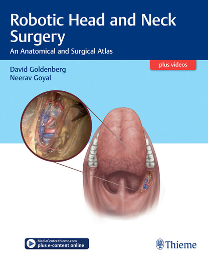 David Goldenberg - Robotic Head and Neck Surgery