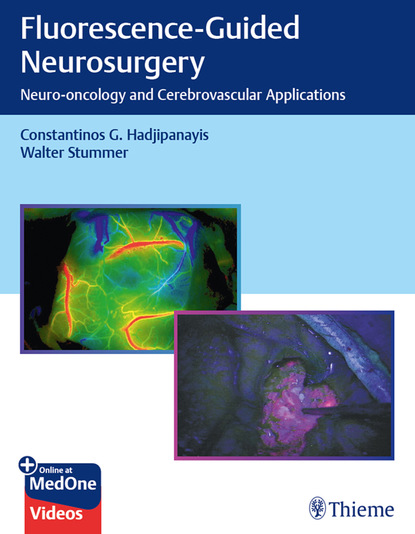 Constantinos G. Hadjipanayis - Fluorescence-Guided Neurosurgery