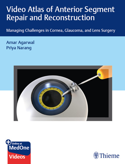 Amar Agarwal - Video Atlas of Anterior Segment Repair and Reconstruction