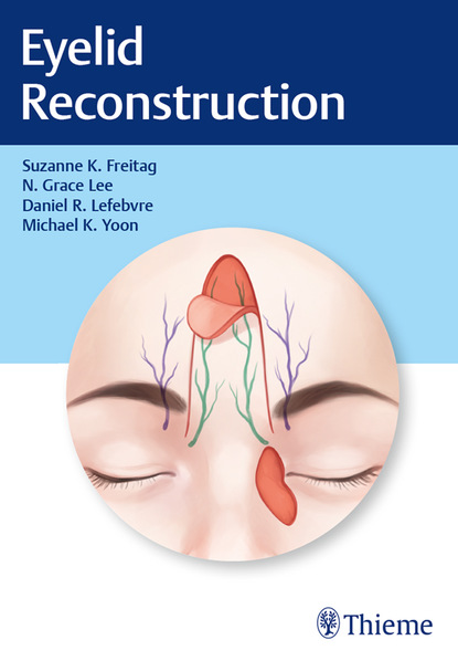 Suzanne K. Freitag - Eyelid Reconstruction