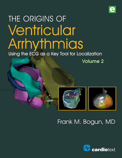 Frank M. Bogun - The Origins of Ventricular Arrhythmias, Volume 2