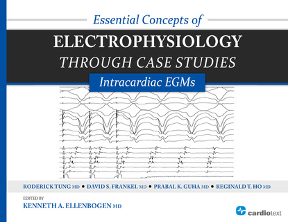 Roderick Tung - Essential Concepts of Electrophysiology through Case Studies: Intracardiac EGMs