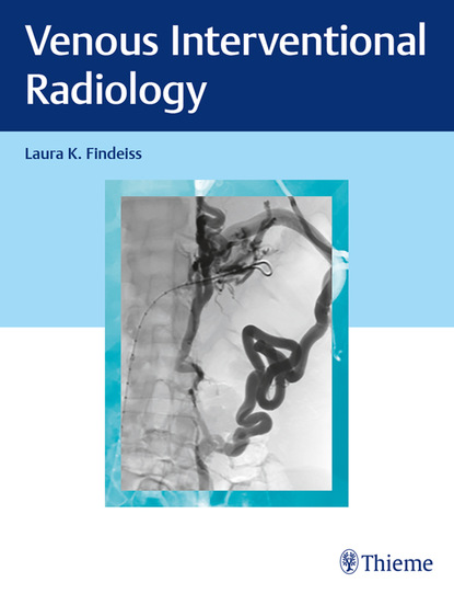 Laura K. Findeiss - Venous Interventional Radiology