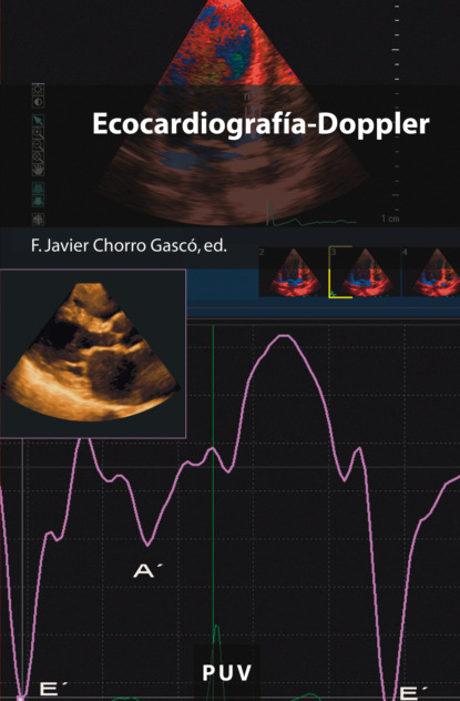 

Ecocardiografía-Doppler