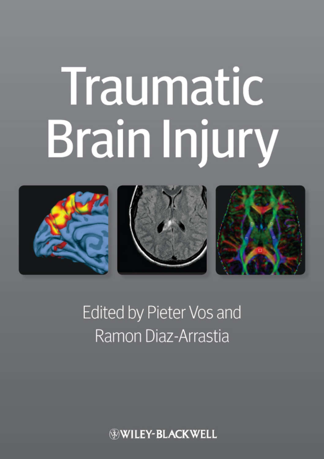 Traumatic brain. Brain Diaz. Textbook and Color Atlas of traumatic injuries to the Teeth. Книга Trauma BEMYVALENTINEEE описание.