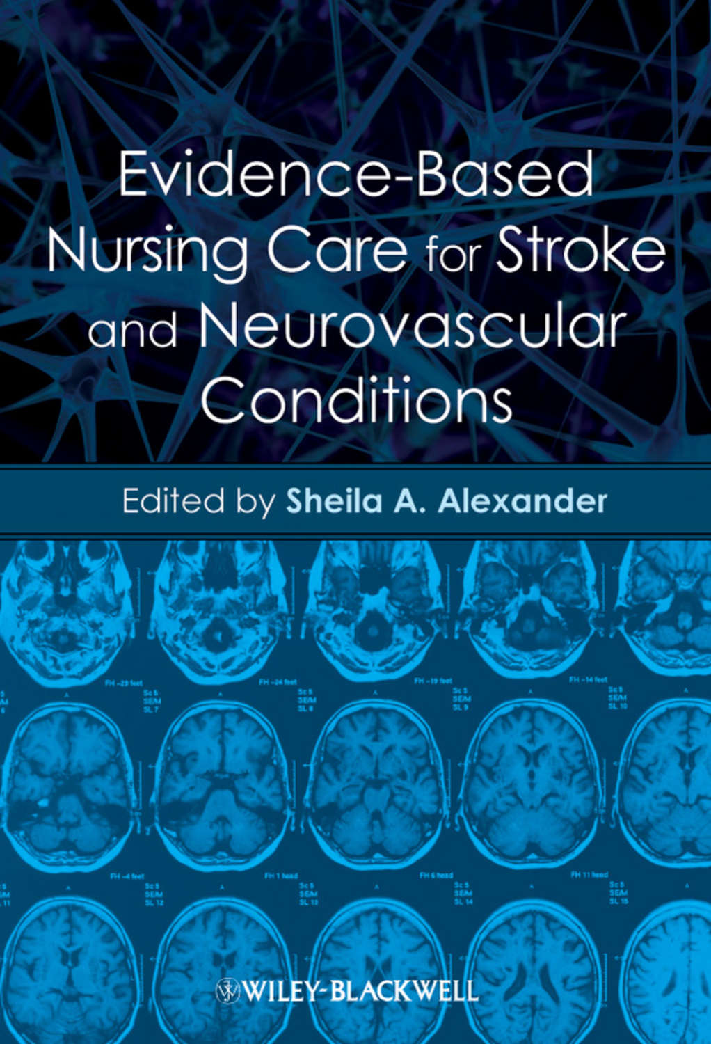  Evidence Based Nursing Care For Stroke And Neurovascular Conditions 