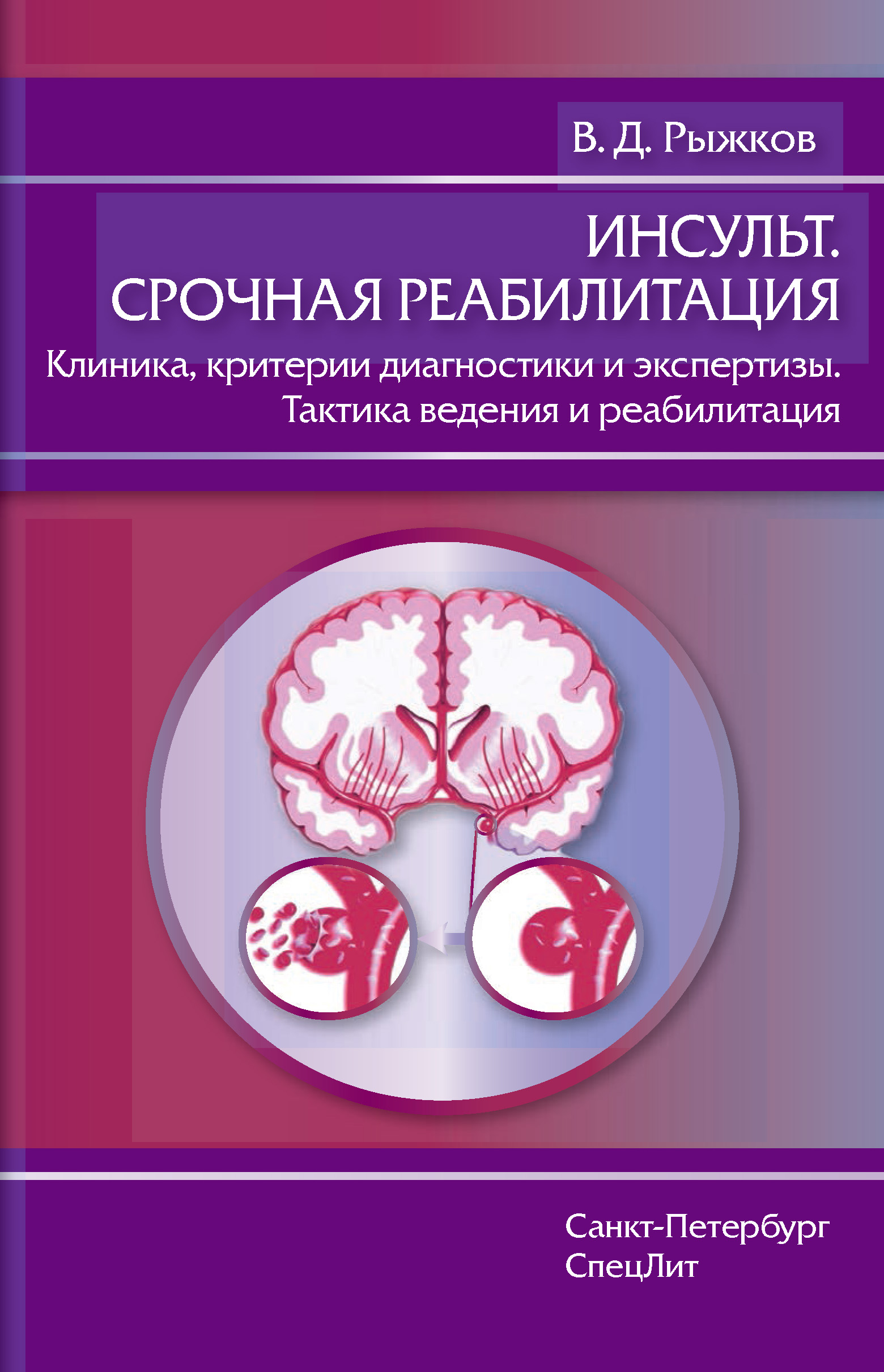 Реабилитация при инсульте презентация