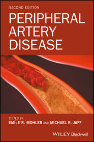 Peripheral Artery Disease